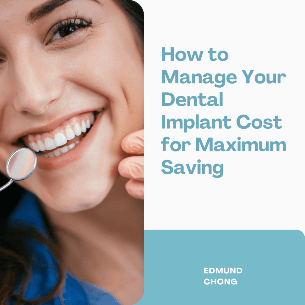 How to manage your dental implant cost for maximum saving